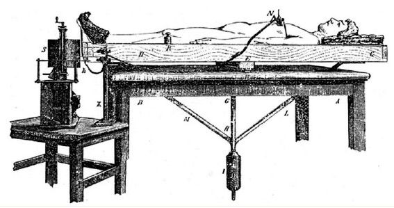 Historical drawing of a patient weighing apparatus